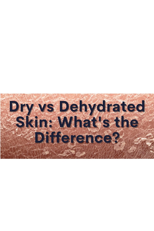 Dry Skin vs. Dehydrated Skin - Skin Tone Beauty Products