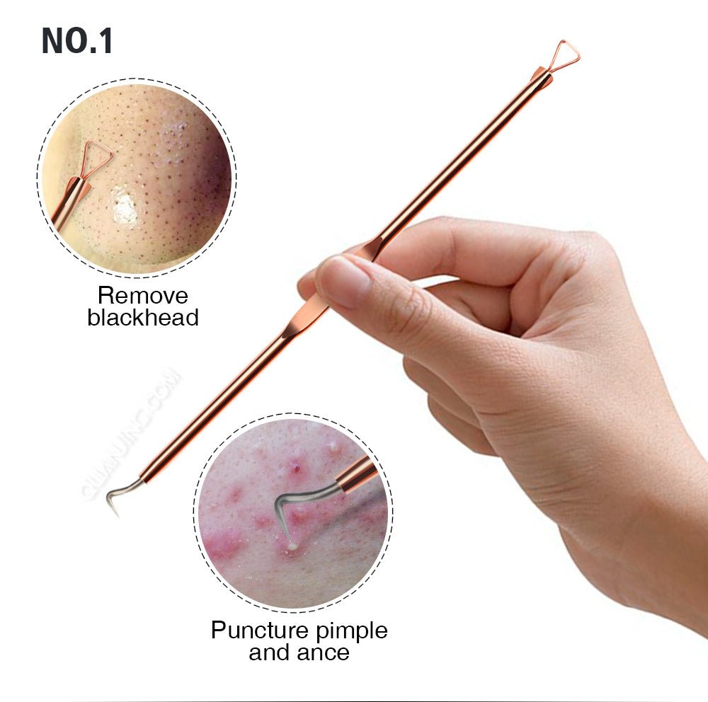 Photo showing a person's hand holding anti-bacterial double-ended acne needles, essential tools for skincare routines.
