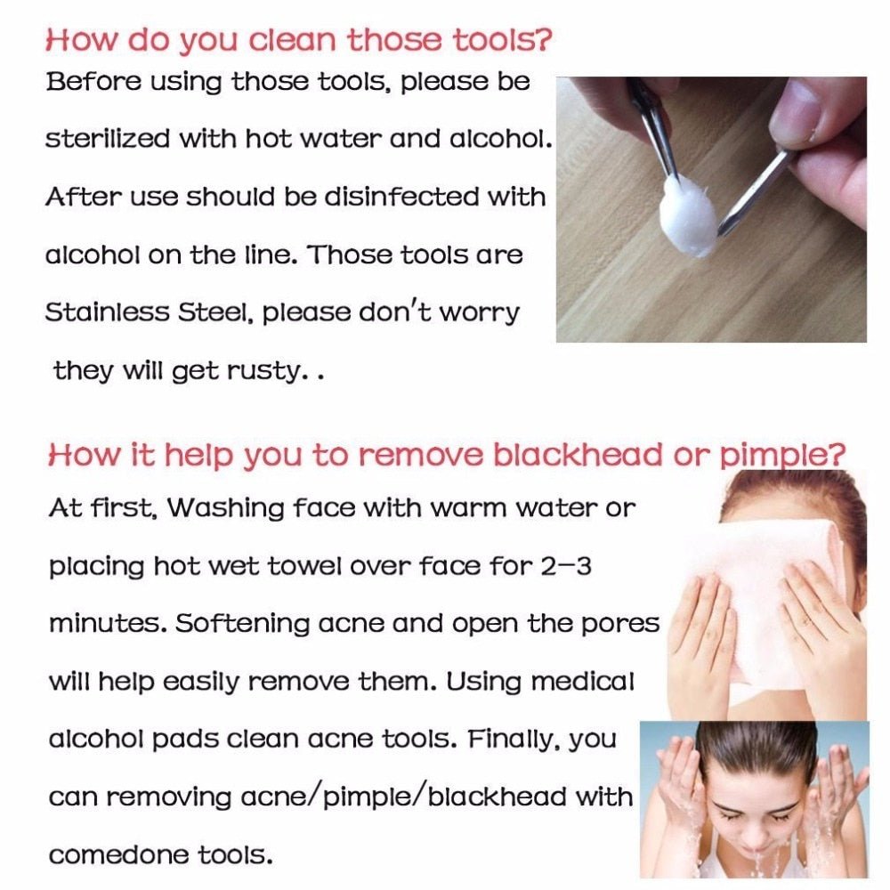 Photo showing the results of using anti-bacterial double-ended acne needles, with text description.