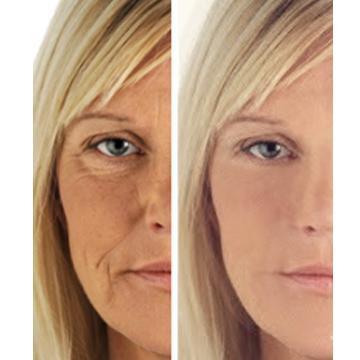 Image of before and after use of a woman who used age perfect night repair cream showcasing glowing skin.