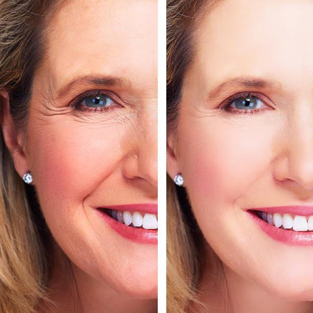 Image of before and after use of a woman who used age perfect night repair cream showcasing glowing skin.